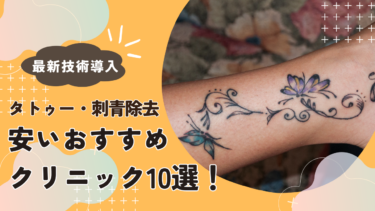 【最新技術導入】タトゥー・刺青除去が安いおすすめクリニック10選！