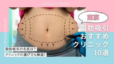 東京で脂肪吸引がおすすめのクリニック10選！口コミが良くて名医がいるのは？
