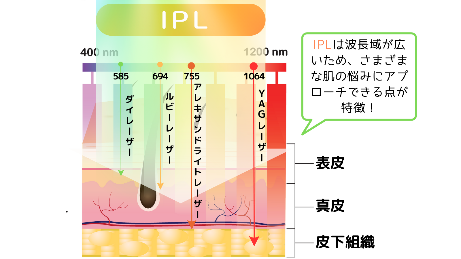 IPLとは