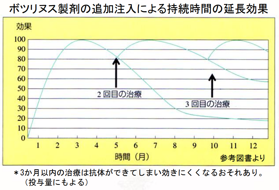 ボツリヌス製剤の追加注入による持続時間の延長効果