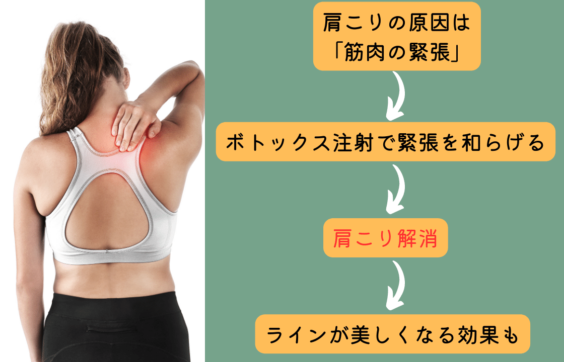 肩ボトックスの仕組み