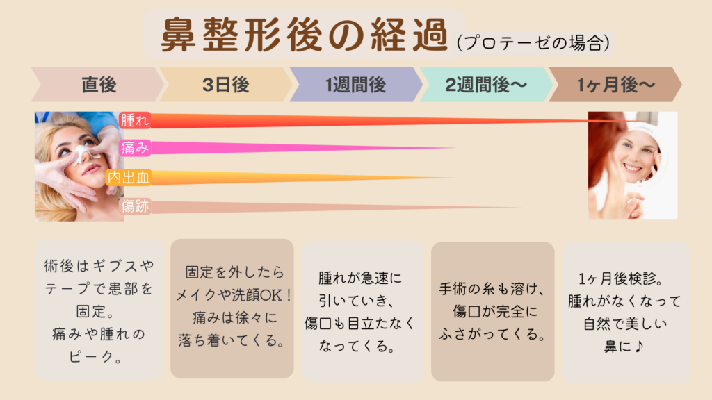 鼻整形の術後経過