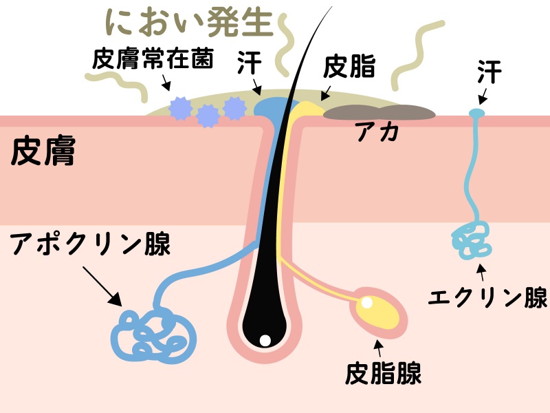 ワキガの仕組み