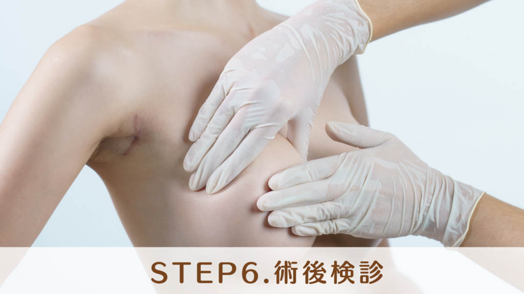 STEP6.術後検診