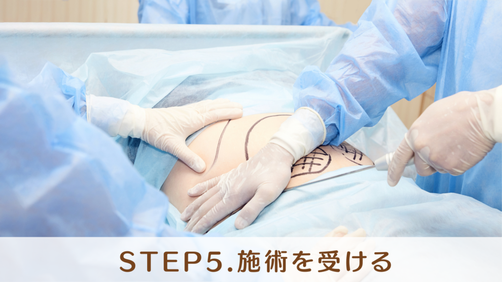 STEP5.施術を受ける