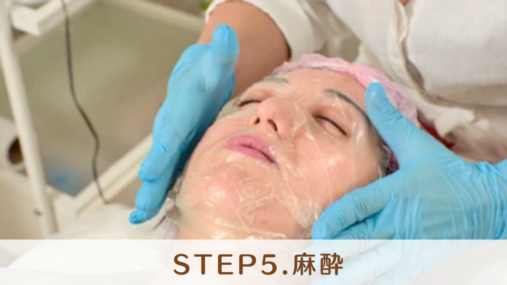 STEP5.麻酔