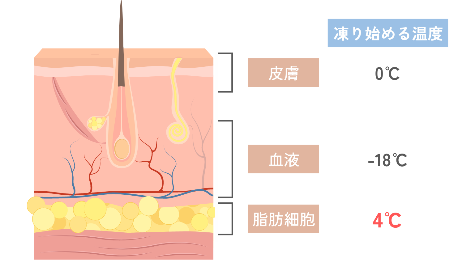 脂肪冷却（クールスカルプティング）で痩せる仕組みは水と脂肪が凍る温度差にある！