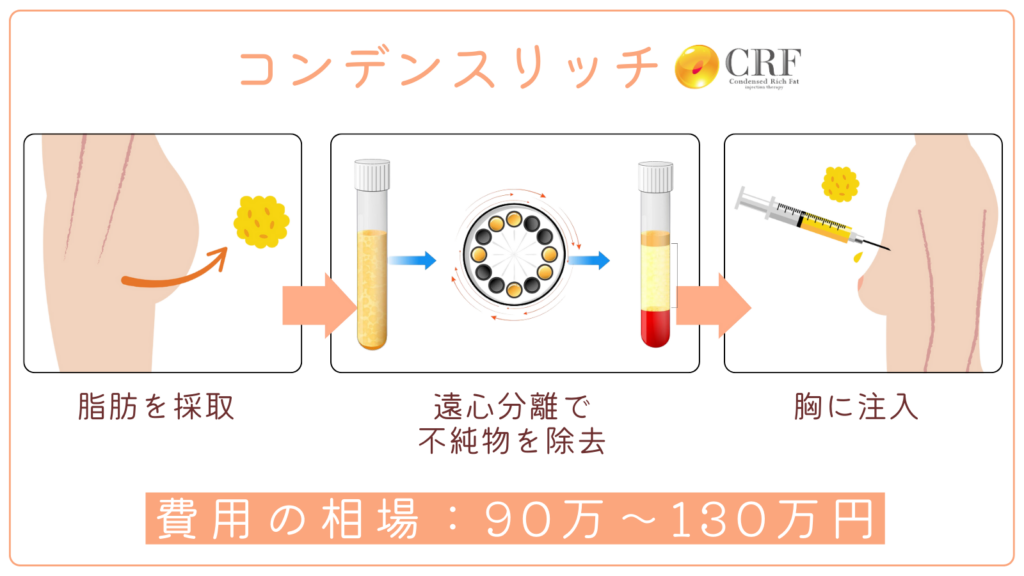 コンデンスリッチの費用相場と仕組み