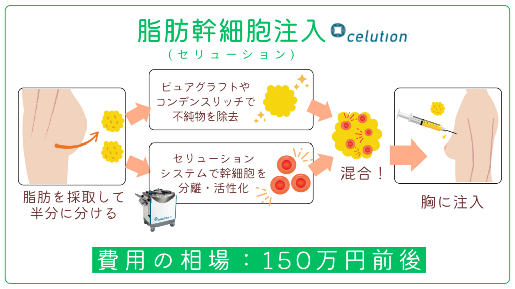 脂肪幹細胞注入(セリューション)の費用相場と仕組み