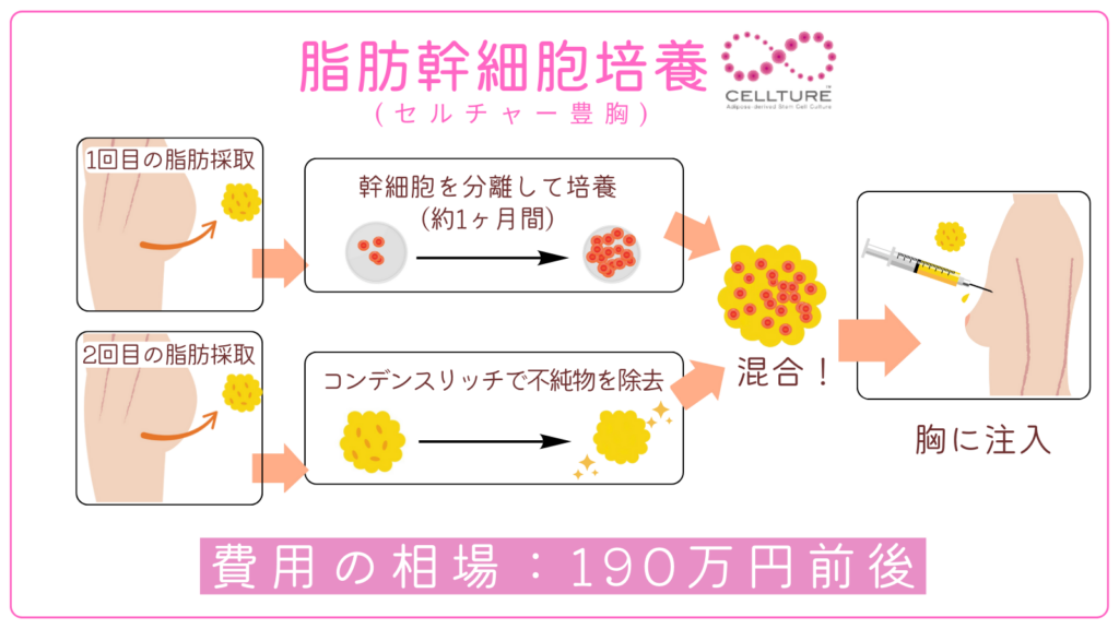 脂肪幹細胞培養(セルチャー豊胸)の費用相場と仕組み