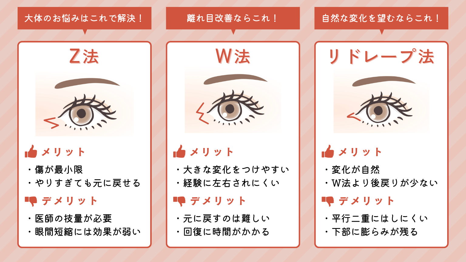 目頭切開　種類