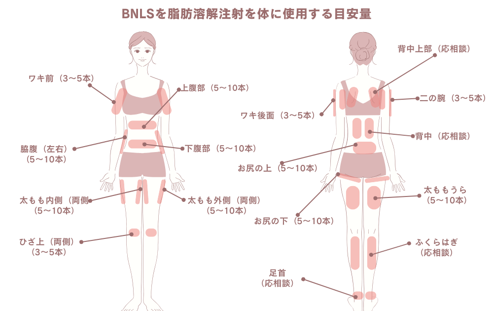 脂肪溶解注射を体に打つ目安