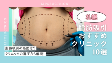 札幌で脂肪吸引がおすすめのクリニック10選！口コミが良くて名医がいるのは？